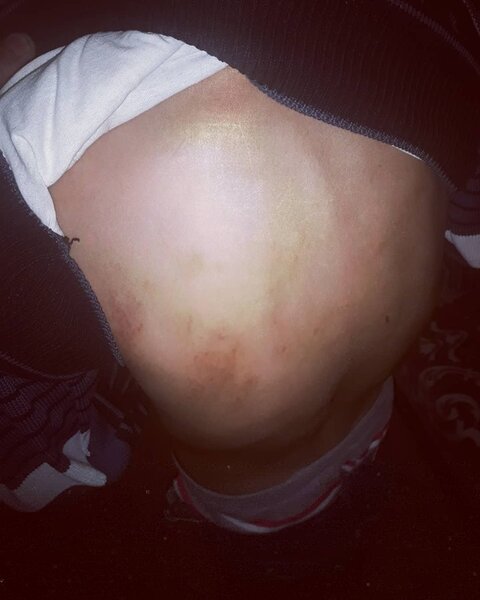 Bakıda uşağı vəhşicəsinə döydülər - FOTO