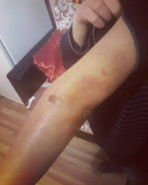 Bakıda uşağı vəhşicəsinə döydülər - FOTO