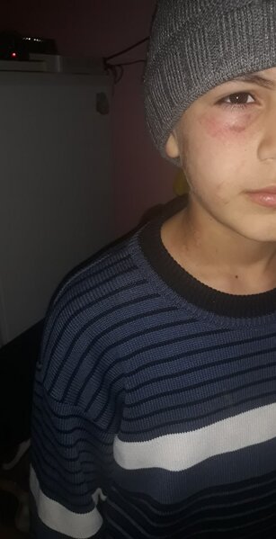 Bakıda uşağı vəhşicəsinə döydülər - FOTO