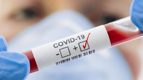 Azərbaycanda daha 105 nəfərdə koronavirus aşkarlandı
