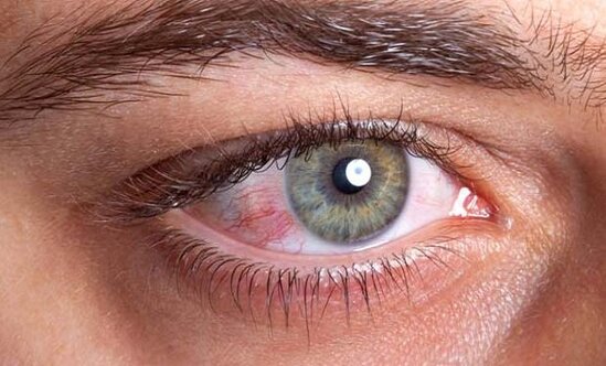 Koronavirus gözə necə təsir edir?