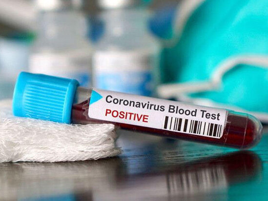 Azərbaycanda daha 257 nəfərdə koronavirus aşkarlandı - 3 nəfər öldü, 202 pasiyent sağaldı