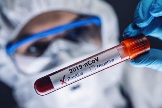 Moskvada daha 28 nəfər koronavirusdan öldü