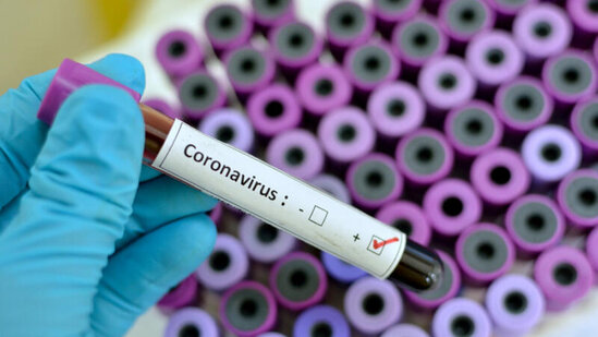 Zakaryan ilk iş günündə koronavirusa yoluxdu