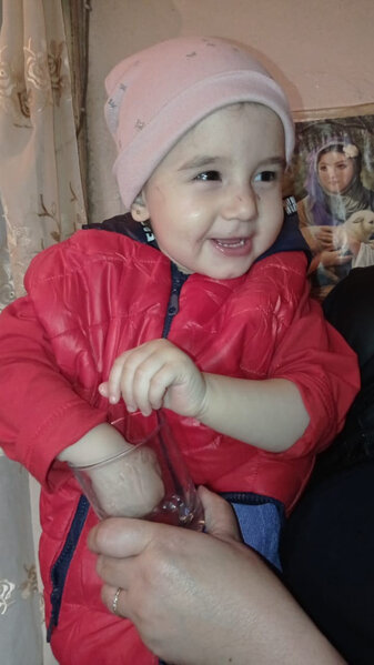 Gəncə terrorunun ən acı üzünü yaşayan 2 yaşlı Nilay - FOTOLAR