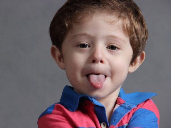 Autizmin ilkin əlamətləri hansılardır? - HƏKİM AÇIQLADI