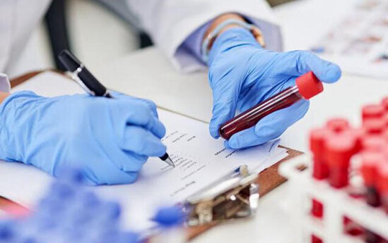 Azərbaycanda koronavirusa yoluxanların sayı artdı - 16 nəfər öldü