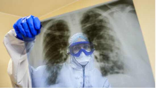 Koronavirus pandemiyası vərəmlə mübarizəni çətinləşdirir - AÇIQLAMA