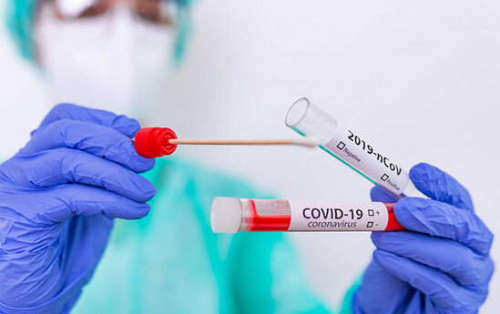 Azərbaycanda koronavirusa yoluxanların sayı AÇIQLANDI