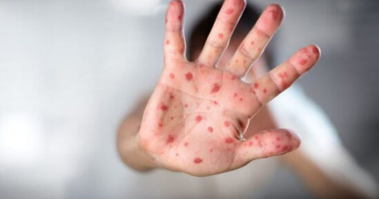 ÜST-dən XƏBƏRDARLIQ: Fırtınadan əvvəlki sakitlikdir, daha bir qorxulu epidemiya gəlir