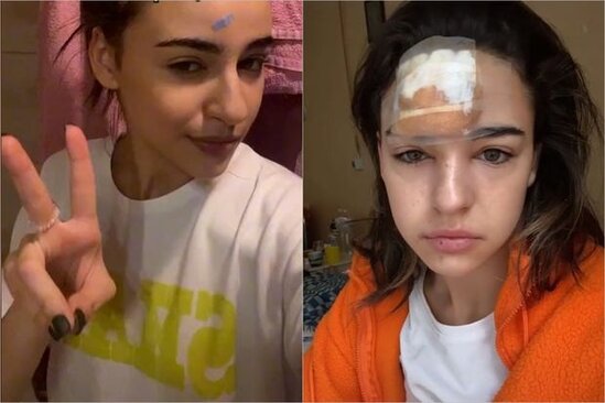 Alnındakı sızanağı sıxan qızın başında şiş yarandı - FOTO-VİDEO