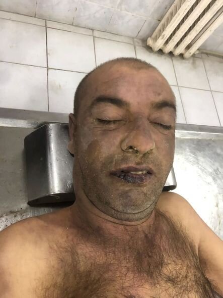 Xızıda naməlum kişi meyiti tapılıb - FOTO