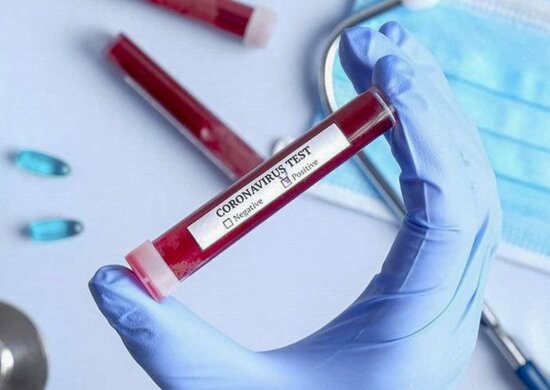 Rusiyada son sutkada 1215 nəfər koronavirusdan öldü