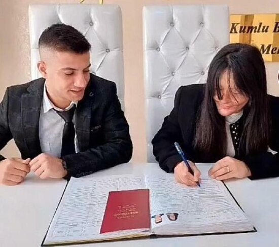 Üzünü yandırıb, onu kor edən adama ərə getdi - FOTO