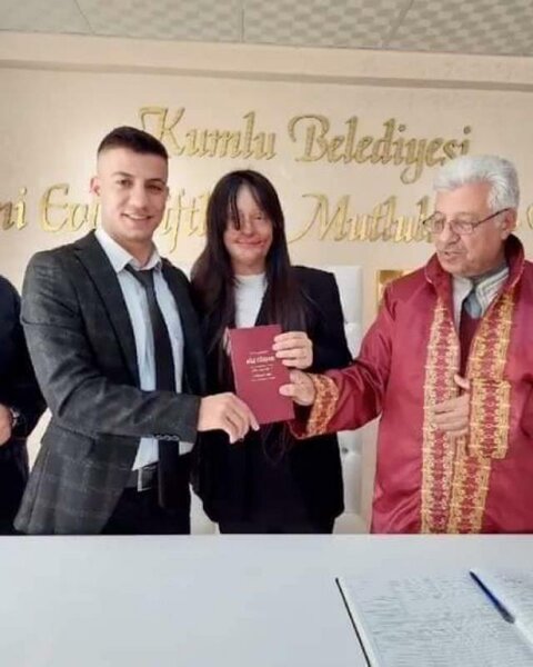 Üzünü yandırıb, onu kor edən adama ərə getdi - FOTO