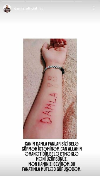 Bakıda müğənni Damla üçün qan tökən ŞƏXS GÖRÜN KİM İMİŞ - FOTO