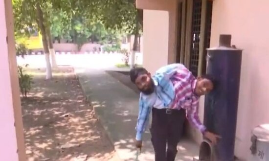 19 yaşlı siyam əkizlərini valideynləri atdı, indi isə onlar... - FOTO