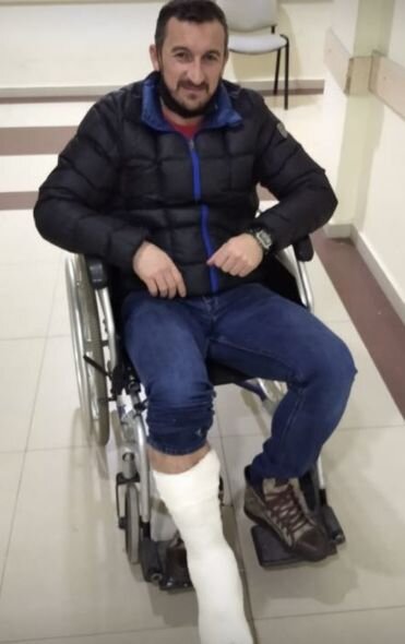 Vüqar Nadirovun ayağı gipsə qoyuldu: "Bu, sınıqdan da betərdir" - FOTO