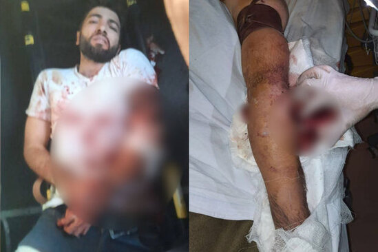 Ermənilərin açdığı atəş nəticəsində "Azercell"in əməkdaşı yaralanıb – FOTO