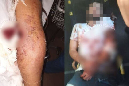 Ermənilərin Ağdamda yaraladıqları şəxs "Bakcell"in əməkdaşı imiş - RƏSMİ