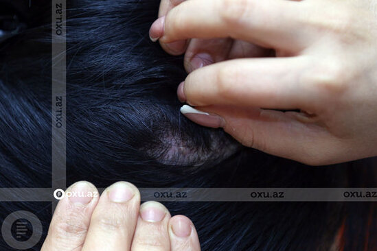 15 yaşında ərə verilən qadın: "Evli ola-ola qonşuluqdakı qıza söz vermişdi ki, onu alacaq" - FOTO