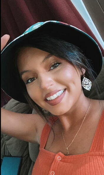 Dodağına gel doldurdu, dodağı çürüdü - FOTO