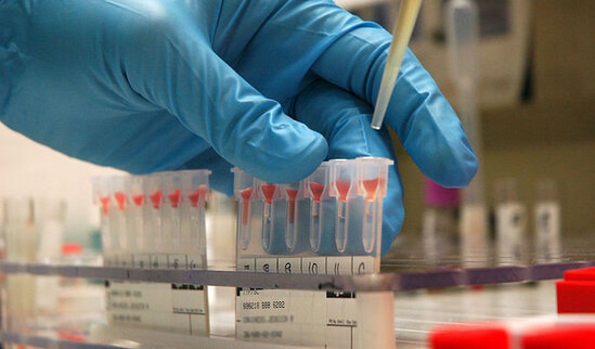 COVID-19-a yoluxmanın əsas artma səbəbi məlum olub