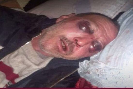 Gürcüstanda azərbaycanlıların toyunda kütləvi dava düşüb - FOTO