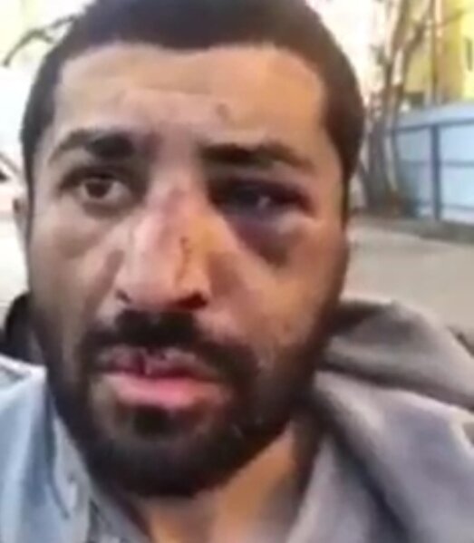 Ukraynada əsir düşən azərbaycanlının videosu yayıldı - VİDEO