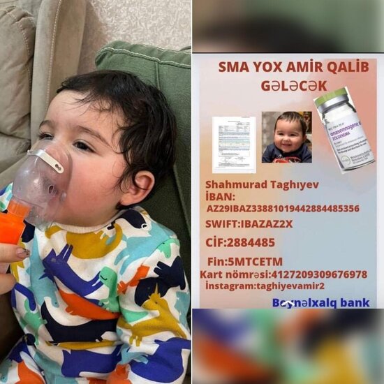 SMA xəstəsi olan balaca Amirin yardımınıza ehtiyacı var - FOTO