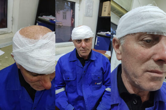 "Azəriqaz"ın işçisini döyəni həbs etdilər