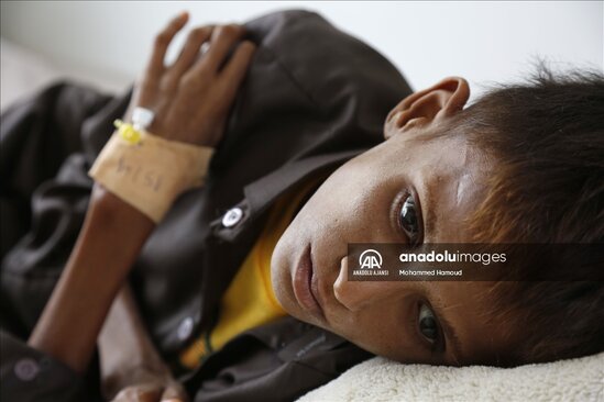 Yəməndəki uşaqların halı ürək ağrıtdı - FOTOLAR