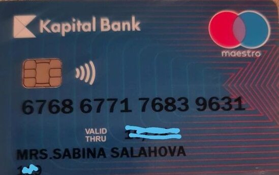 Doqquz yaşlı Nurayın 10 gün vaxtı qaldı: 3500 manat pul lazımdır - FOTO