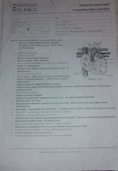 Anadangəlmə ürək qüsurlu gənc yataq xəstəsidir: Kömək istəyir - FOTO