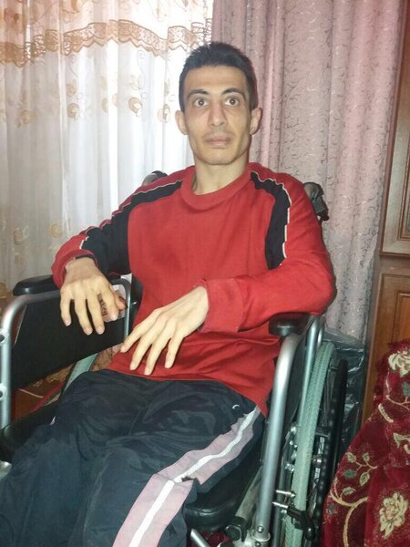 "Müalicə alıb sağalaraq ayağa qalxa bilər" - ONUN YARDIMINIZA EHTİYACI VAR - VİDEO