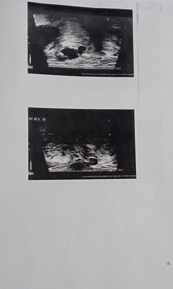 İki uşaq anasının köməyə ehtiyacı var - FOTO