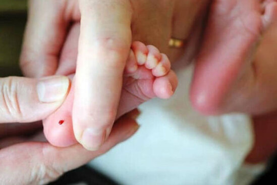 Azərbaycanda topuq testinin tətbiqinə başlanılıb