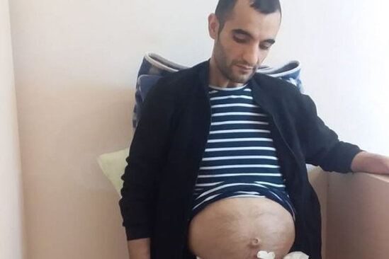 29 yaşlı Tunar ağır xəstəlikdən əziyyət çəkir - FOTO