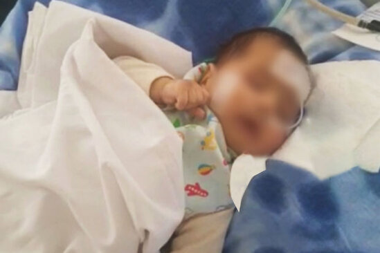 Bakıda bir həftə komada qalan üçaylıq körpənin həyatı xilas edildi