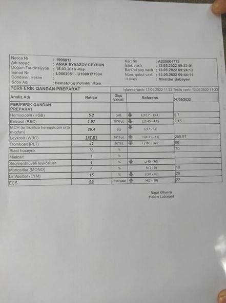 Altı yaşlı Anara kömək edək - FOTO