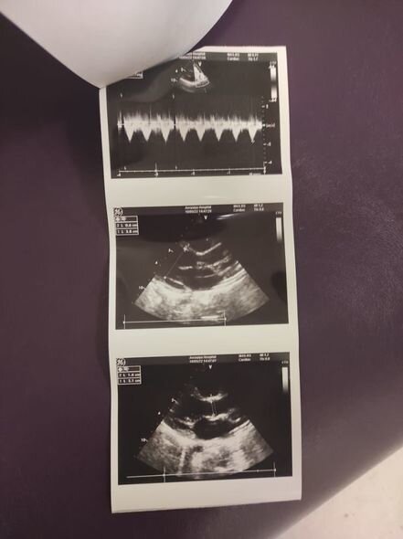 Altı yaşlı Anara kömək edək - FOTO