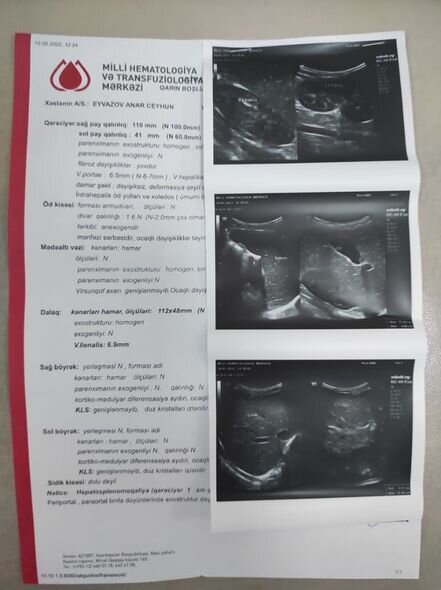 Altı yaşlı Anara kömək edək - FOTO