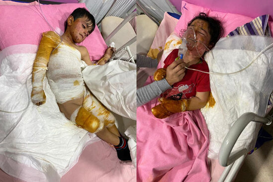 Şamaxıda yanğın: Azyaşlı bacı-qardaşın vəziyyəti ağırdır - FOTO