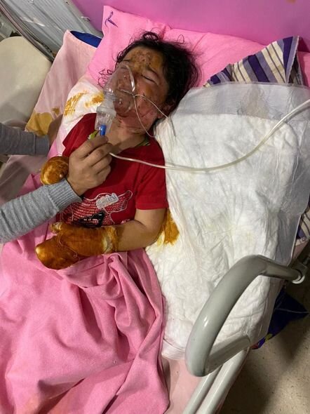 Şamaxıda yanğın: Azyaşlı bacı-qardaşın vəziyyəti ağırdır - FOTO