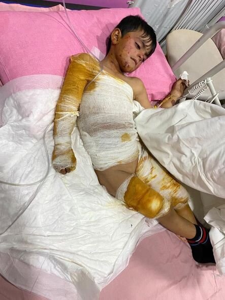 Şamaxıda yanğın: Azyaşlı bacı-qardaşın vəziyyəti ağırdır - FOTO