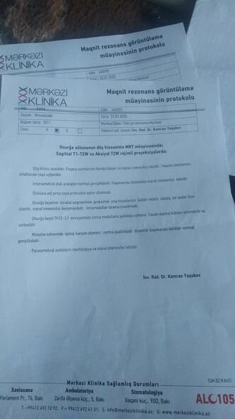 11 yaşlı Sadiq leykozdan yerimə qabiliyyətini itirib - FOTO