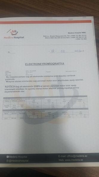 11 yaşlı Sadiq leykozdan yerimə qabiliyyətini itirib - FOTO