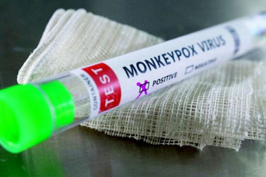 Türkiyədə meymunçiçəyinə ilk yoluxma TƏSDİQLƏNDİ