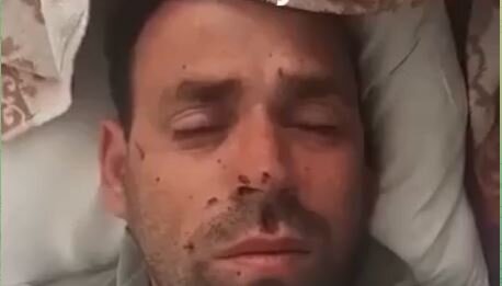 Dünən iti ilə minaya düşən ANAMA əməkdaşının VİDEOSU