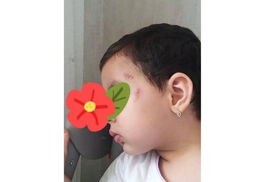 Azərbaycanda daha bir bağçada dəhşətli hadisə — Bağça rəhbərliyi isə kamera görüntülərini təqdim etməkdən yayınır (FOTOFAKT)